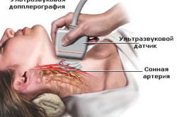 Проведение УЗИ щитовидной железы