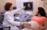Когда и зачем назначают УЗИ 3Д при беременности?