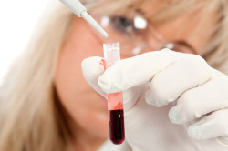 Анализ на ДНК по крови