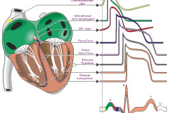 Схема ЭКГ сердца