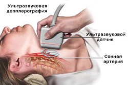 Доплер-УЗИ щитовидной железы