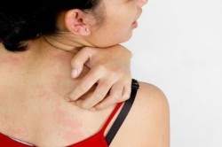  Обширные очаги воспаления на коже - противопоказание к проведению УЗИ 