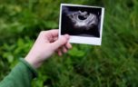 Зачем делают первое УЗИ при беременности
