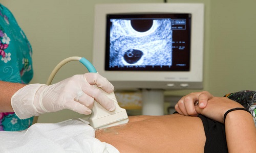 Вред от УЗИ на ранних сроках беременности