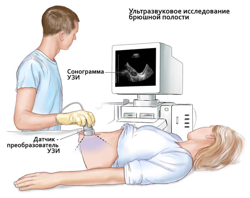 Что можно есть пациентам при подготовке к УЗИ брюшной полости?
