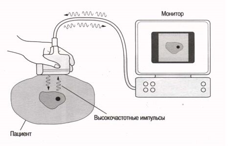Специфика УЗИ мягких тканей